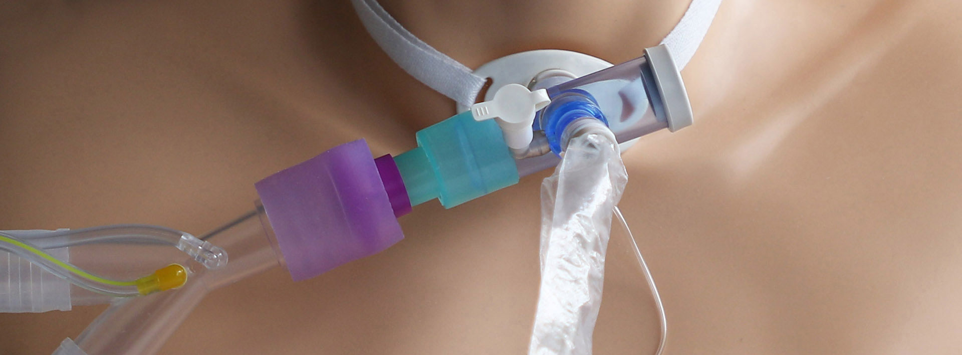 The PMV® AD1522 Step-down Adapter and PMV®AD22 Flexible Silicone Adapter The PMV® AD1522 Step-down Adapter and PMV®AD22 Flexible Silicone Adapter
