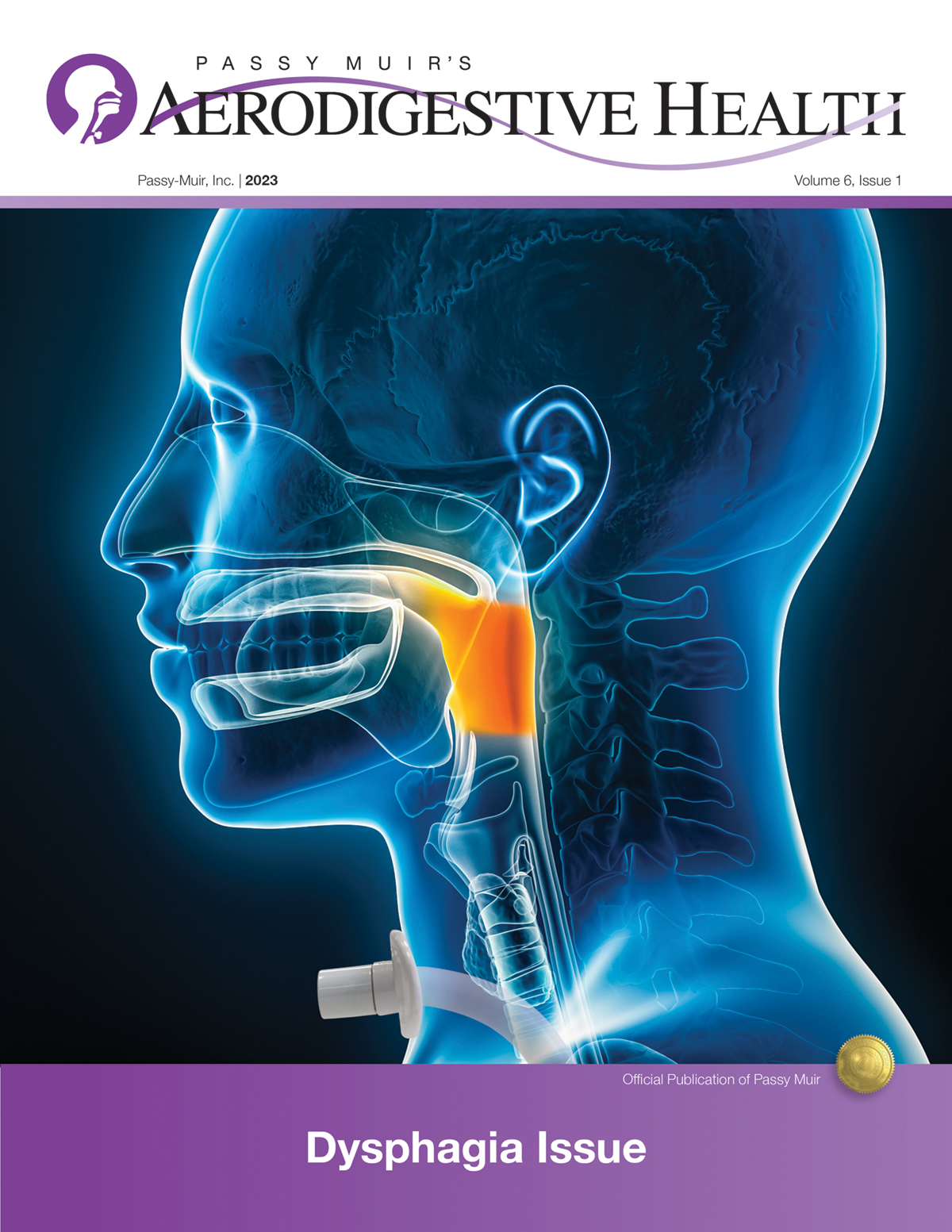 Dysphagia Issue
